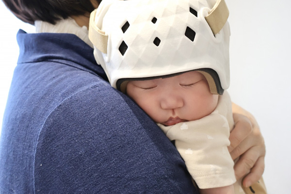 あたまの形外来